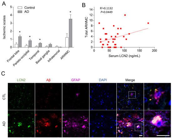 Role of Lipocalin-2 in Amyloid-Beta Oligomer-Induced Mouse Model of Alzheimer’s Disease