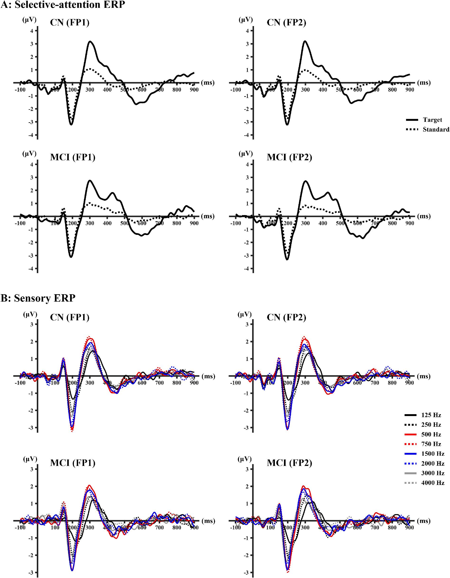 Combining EEG, event-related potentials, and MRI biomarkers for detection of mild cognitive impairment: A machine learning approach