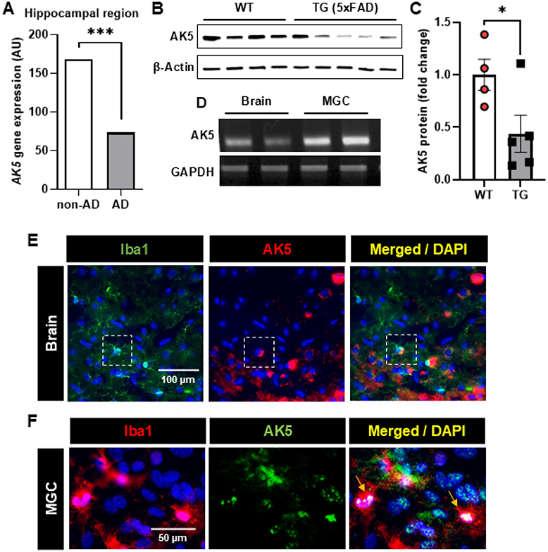 Adenylate kinase 5, a novel genetic risk factor for Alzheimer's disease, regulates microglial inflammatory activation